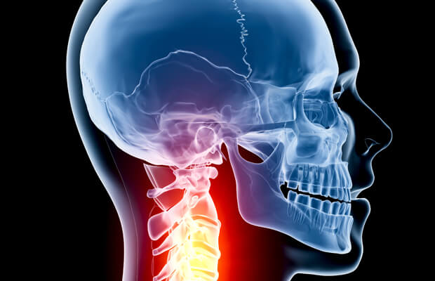 Какво представляват туморите на гръбначния мозък и какви са симптомите?