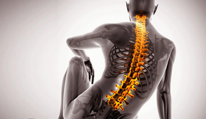 Какво представляват гръбначните заболявания? Гръбначни операции и лечение. - превю