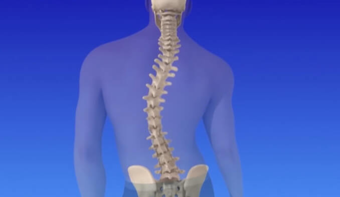 Какво представлява туморът на гръбначния стълб? - превю